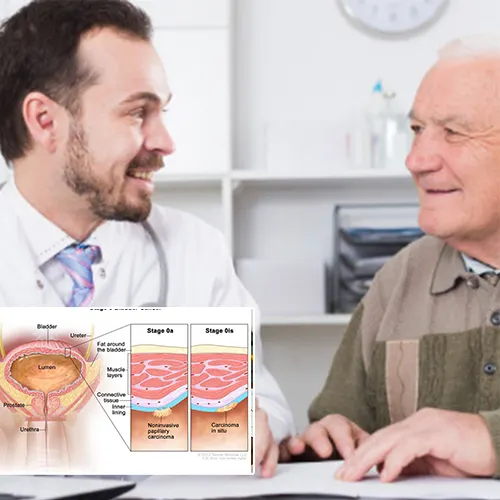 Welcome to   Desert Ridge Surgery Center 
: Your Guide to Choosing a Penile Implant
